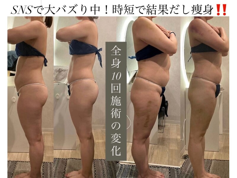 痩身革命 大宮店 外観・エントランス
